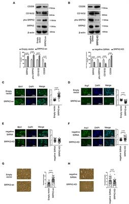 SRPK2 Expression and Beta-Amyloid Accumulation Are Associated With BV2 Microglia Activation